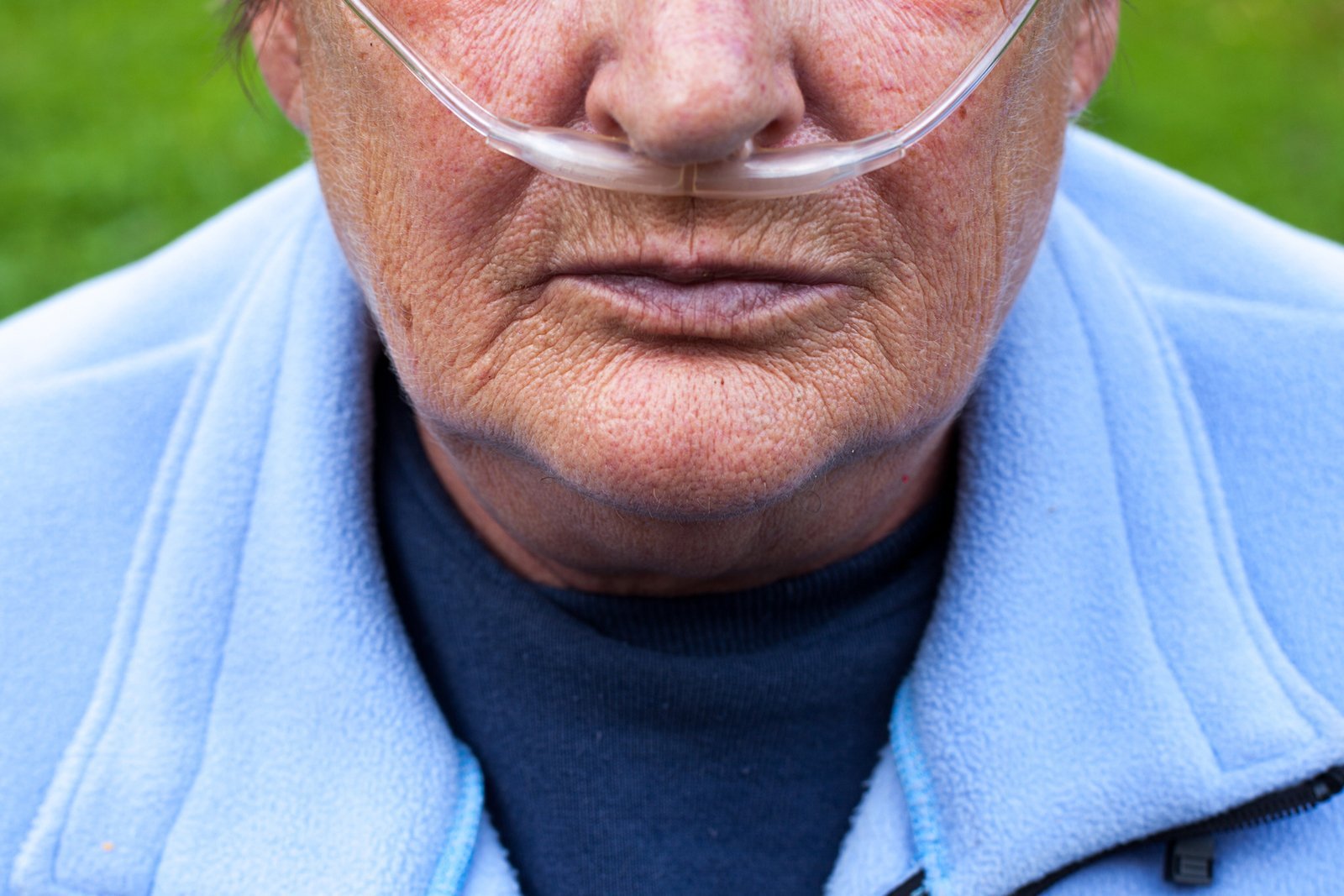 Mann mit Sauerstoff-Schlauch in der Nase.