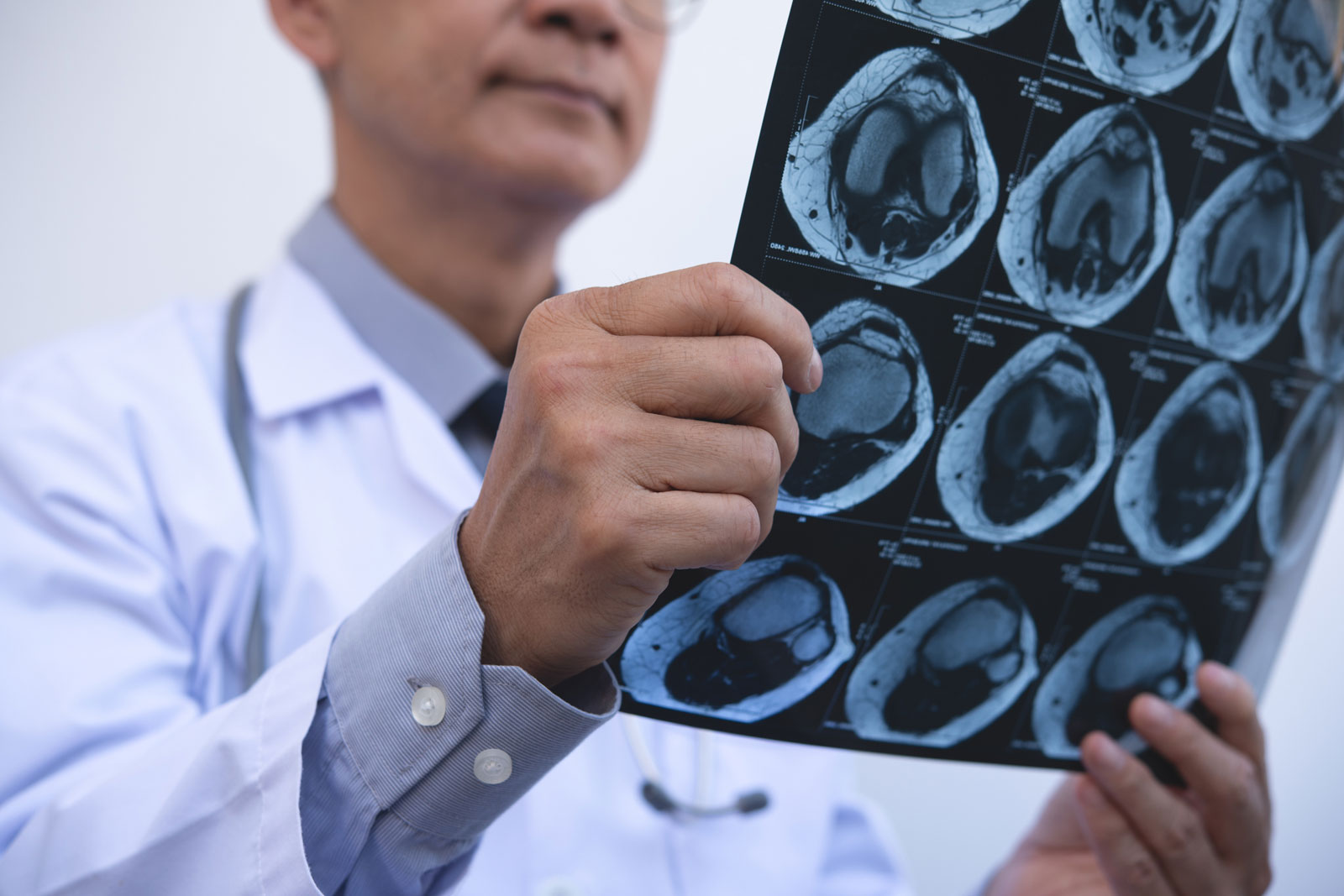 Arzt begutachtet Röntgenbild für eine Arthrose Diagnose